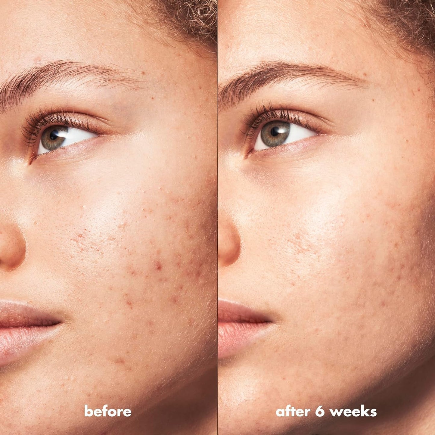 e.l.f. SKIN Blemish Breakthrough Calming Water Cream